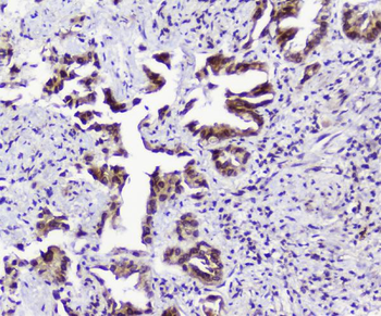 TPR Rabbit Polyclonal Antibody
