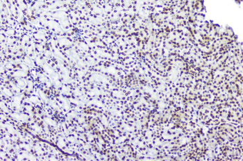 TPR Rabbit Polyclonal Antibody