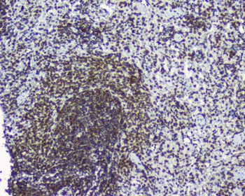 TPR Rabbit Polyclonal Antibody