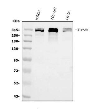TPR Rabbit Polyclonal Antibody