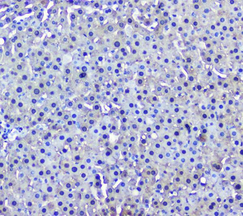GSTM1 Antibody (monoclonal, 11F2)