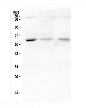 ARSA Mouse Monoclonal Antibody