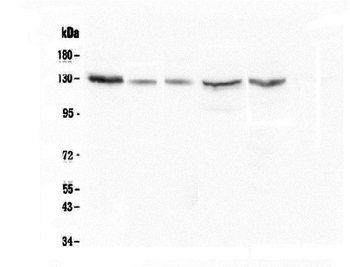 CASR Mouse Monoclonal Antibody