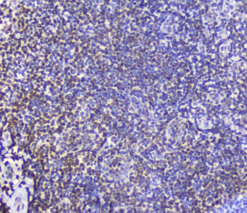 AHR Rabbit Polyclonal Antibody