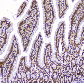 AHR Rabbit Polyclonal Antibody