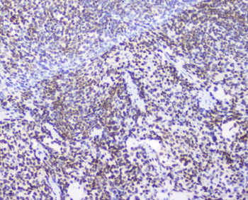 AHR Rabbit Polyclonal Antibody