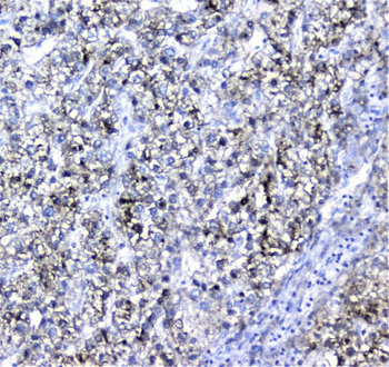 Alpha 1 microglobulin/AMBP Rabbit Polyclonal Antibody