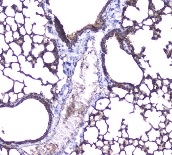 Aquaporin 5/AQP5 Rabbit Polyclonal Antibody