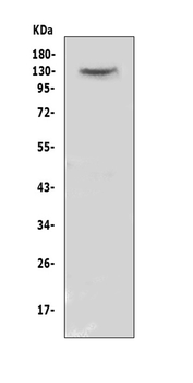 CACNA2D2 Rabbit Polyclonal Antibody