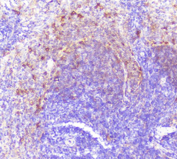 Caspase-2/CASP2 Rabbit Polyclonal Antibody