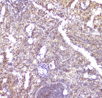 CCL6 Rabbit Polyclonal Antibody