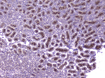 CCL8 Rabbit Polyclonal Antibody
