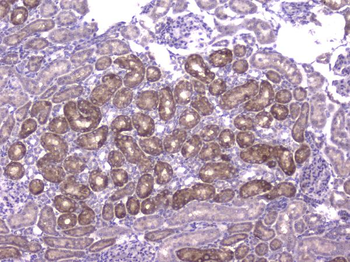 CCL8 Rabbit Polyclonal Antibody