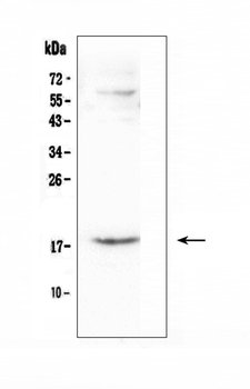 CCL16 Rabbit Polyclonal Antibody