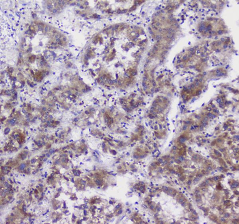 CFP Rabbit Polyclonal Antibody
