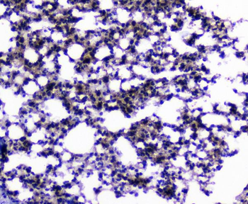 CIC Rabbit Polyclonal Antibody