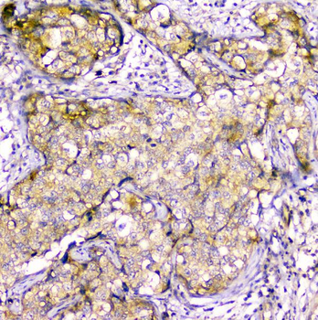 Creatine Kinase MM/CKM Rabbit Polyclonal Antibody