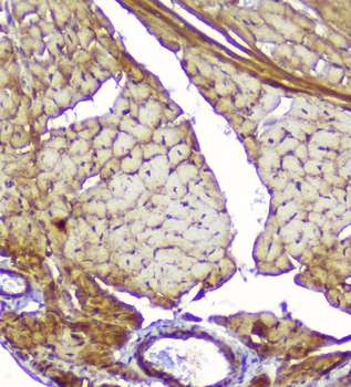 Creatine Kinase MM/CKM Rabbit Polyclonal Antibody