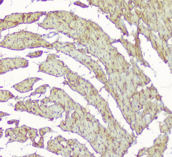 Creatine Kinase MM/CKM Rabbit Polyclonal Antibody