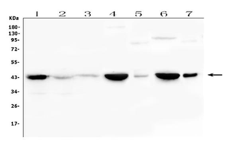 Creatine Kinase MM/CKM Rabbit Polyclonal Antibody