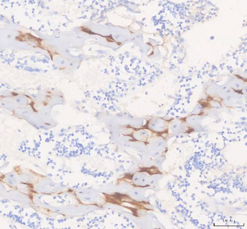 COMP Rabbit Polyclonal Antibody