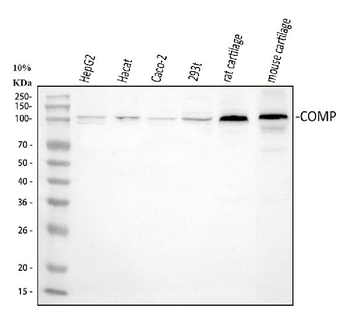 COMP Rabbit Polyclonal Antibody