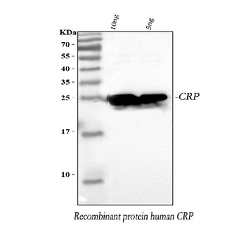 C Reactive Protein/CRP Antibody