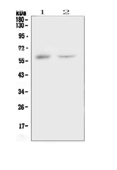 CSF1 Rabbit Polyclonal Antibody