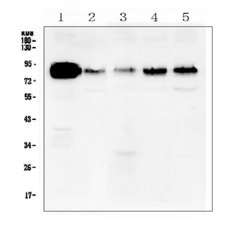 Cortactin/CTTN Antibody