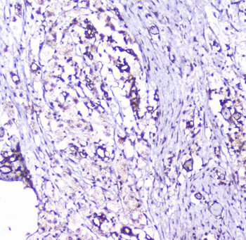 Cortactin/CTTN Antibody