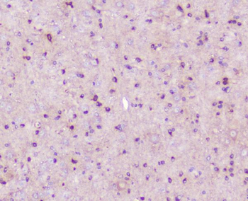 ELAVL2 HuB Rabbit Polyclonal Antibody
