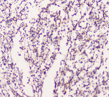 EML4 Rabbit Polyclonal Antibody