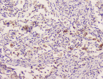 EML4 Rabbit Polyclonal Antibody