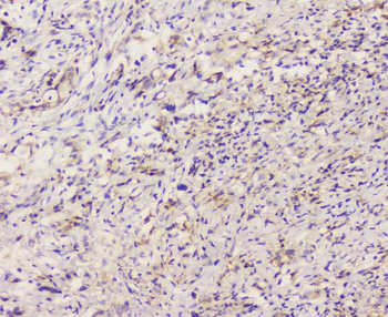 EML4 Rabbit Polyclonal Antibody