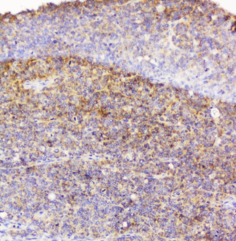EML4 Rabbit Polyclonal Antibody