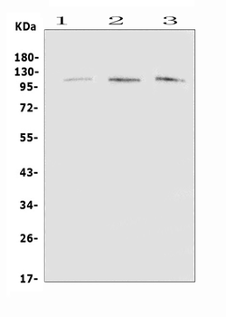 EML4 Rabbit Polyclonal Antibody