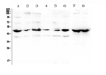NSE/ENO2 Antibody
