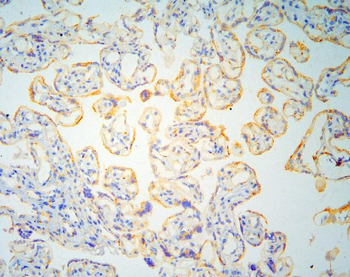 GM130/GOLGA2 Rabbit Polyclonal Antibody