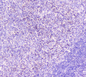 GM130/GOLGA2 Rabbit Polyclonal Antibody