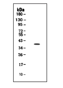 TIM 1/HAVCR1 Rabbit Polyclonal Antibody