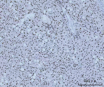 HMGN2 Rabbit Polyclonal Antibody