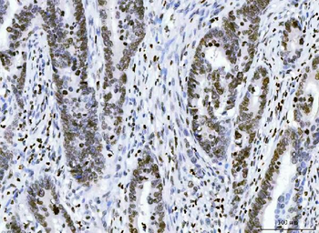 HMGN2 Rabbit Polyclonal Antibody