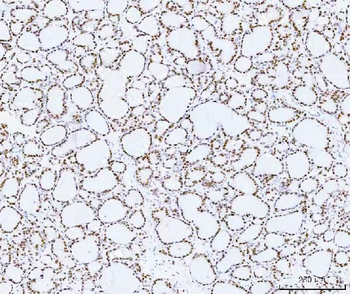 HMGN2 Rabbit Polyclonal Antibody