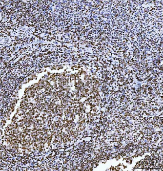 HMGN2 Rabbit Polyclonal Antibody