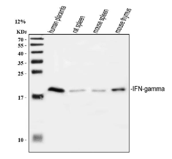 Interferon gamma/IFNG Rabbit Polyclonal Antibody