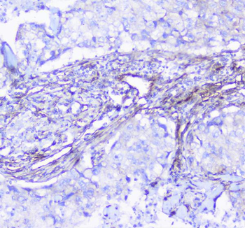 INPPL1 Antibody