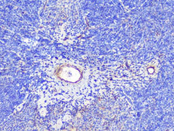 INPPL1 Antibody