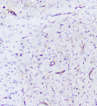 INPPL1 Antibody