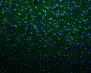 Kv1.1 potassium channel/KCNA1 Rabbit Polyclonal Antibody