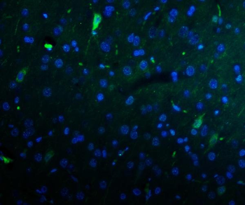 Kv1.1 potassium channel/KCNA1 Rabbit Polyclonal Antibody